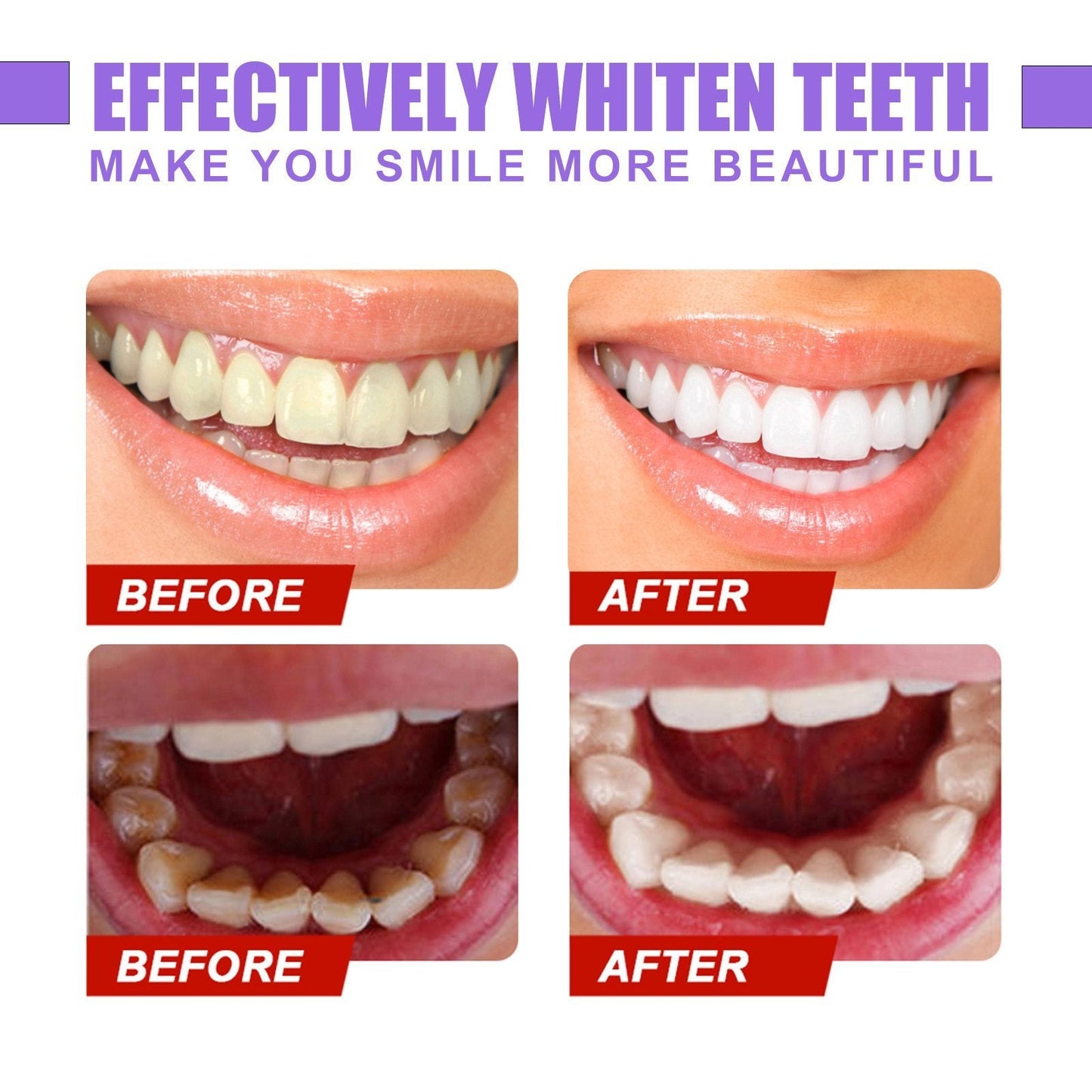 🔥🔥Teeth Colour Corrector Serum