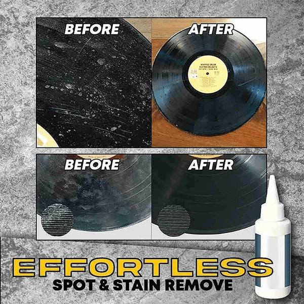 🔥 Vinyl Records Remover(30ml)